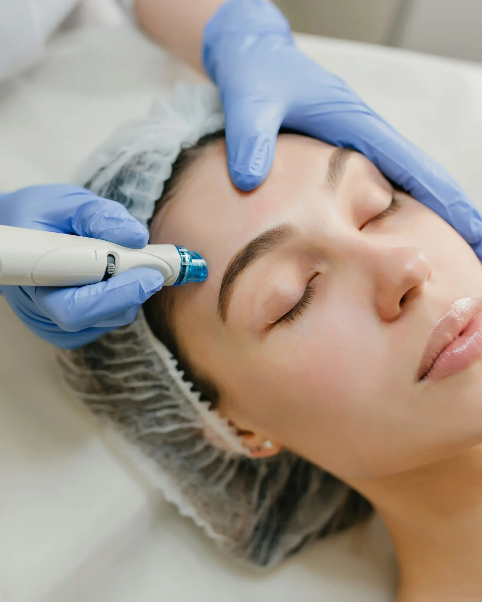 Dermapen (Microneedling)
